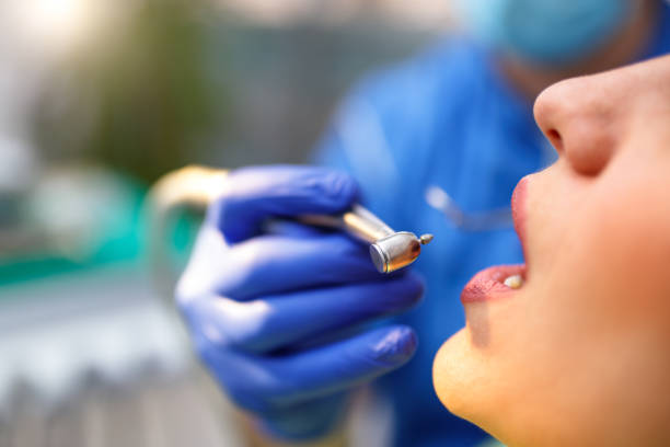 Laser Dentistry in Avon, OH
